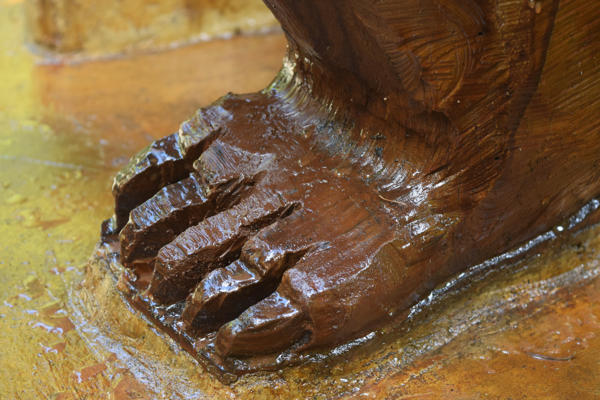 Close-up of the foot with the repaired toes